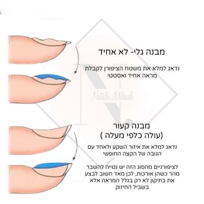 של סוגים של מבנה ציפורנים מצוי ורצוי .2